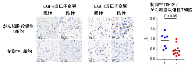 図2. EGFR遺伝子変異の有無による肺がん組織内の免疫細胞数の免疫染色を用いた比較検討