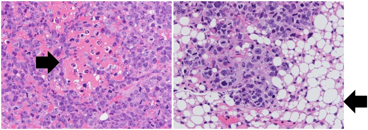 図1. 骨肉腫細胞を移植し増殖させたたマウスに NCB-0846を投与すると脂肪組織に変化