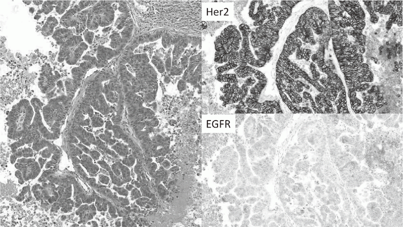 Figure 2.  Pathological features of PDX