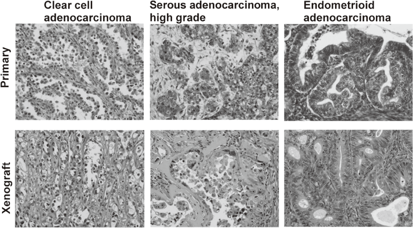 Figure 1. Pathological fidelity of xenograft tissue of newly established ovarian cancer cell lines(Full Size)