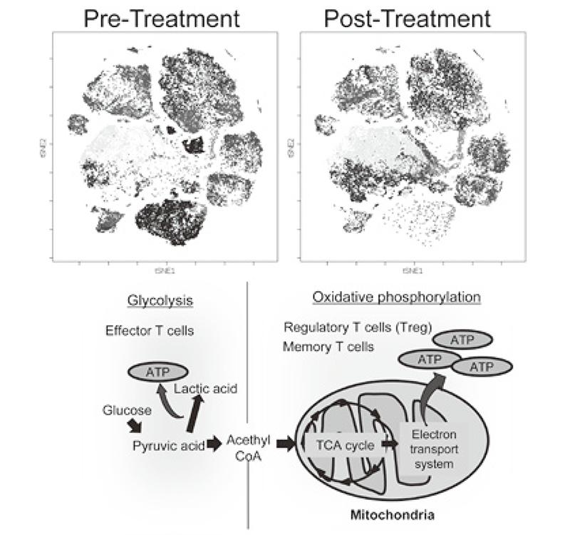 Figure 2. Representative image of clinical-sample analysis (pre- and post-treatments), and metabolic pathway map in lymphocytes