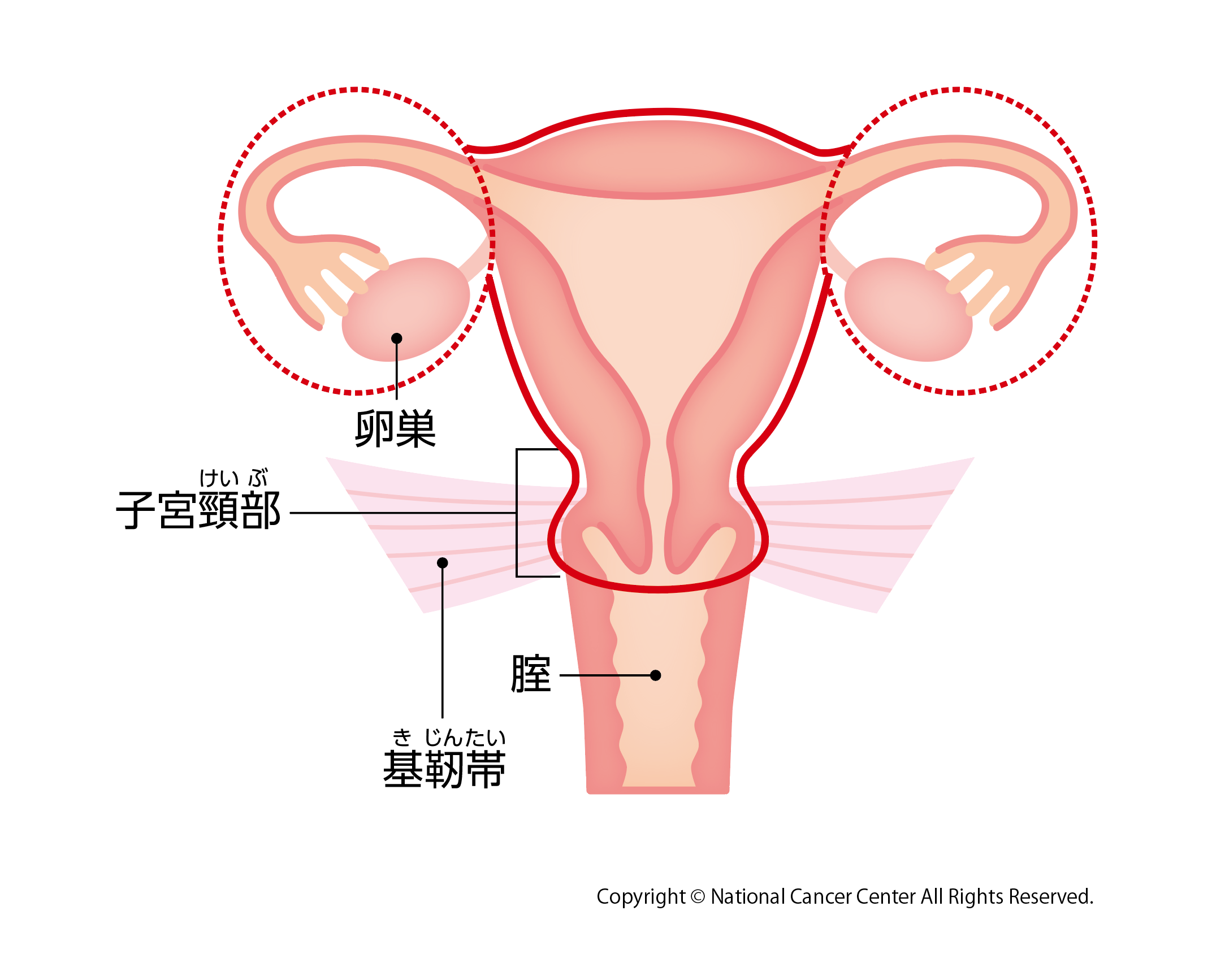 単純子宮全摘出術