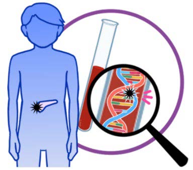 膵がんのゲノム医療
