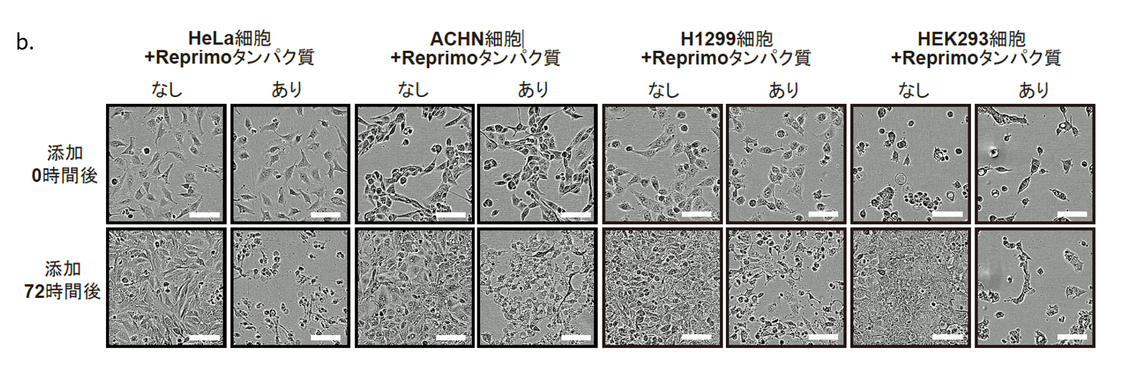 図２-b.Reprimoタンパク質を添加したがん細胞の72時間後の顕微鏡写真