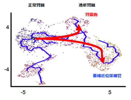 図4 近位尿細管細胞からの嚢胞への変化の画像