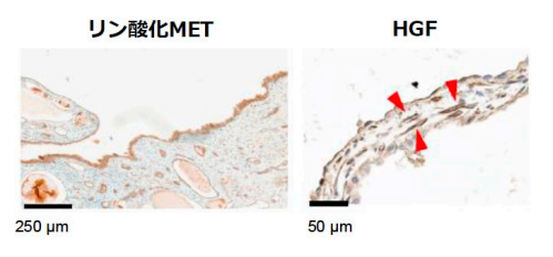 図5 線維芽細胞からのHGF分泌と嚢胞のMET活性化の画像