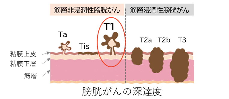 図１