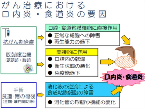 口内炎・食道炎　画像　001