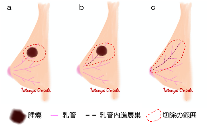 乳房部分8