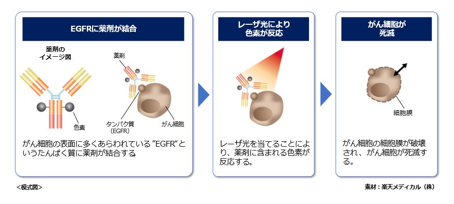光免疫療法の説明の画像