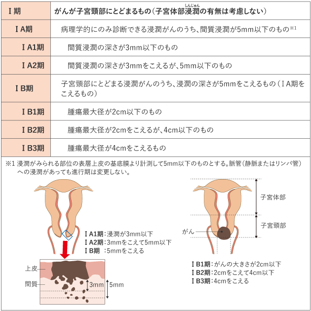 cervix_uteri_table01.png