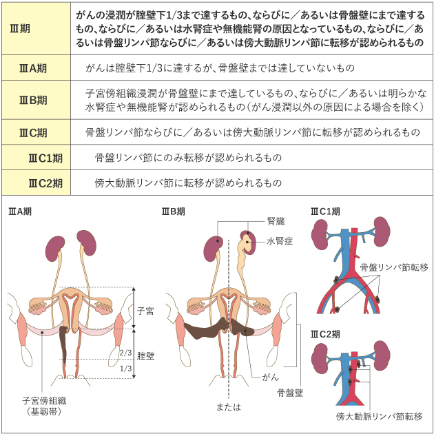 cervix_uteri_table01_03.png