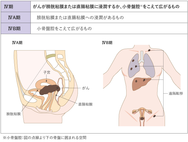 cervix_uteri_table01_04.png