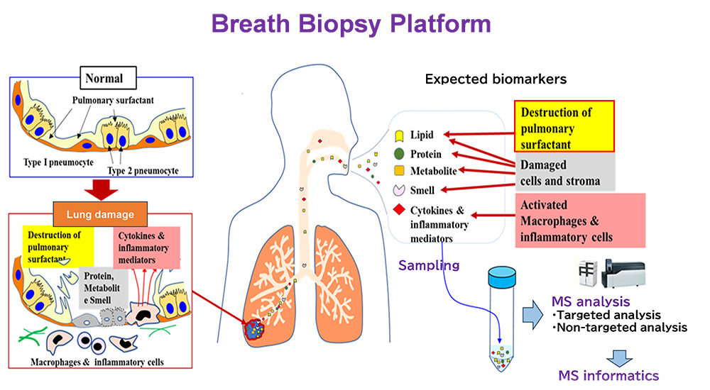 BreathBiopsy研究の画像
