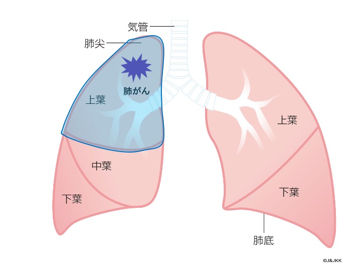 葉切