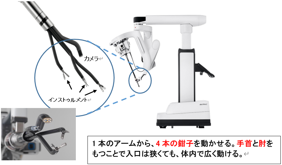 1本のアームから、4本の鉗子を動かせる。手首と肘をもつことで入口は狭くても、体内で広く動ける。
