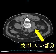 IVR_Description_Biopsy_001.jpg