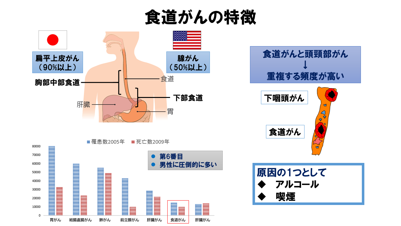 大腸がんの特徴図