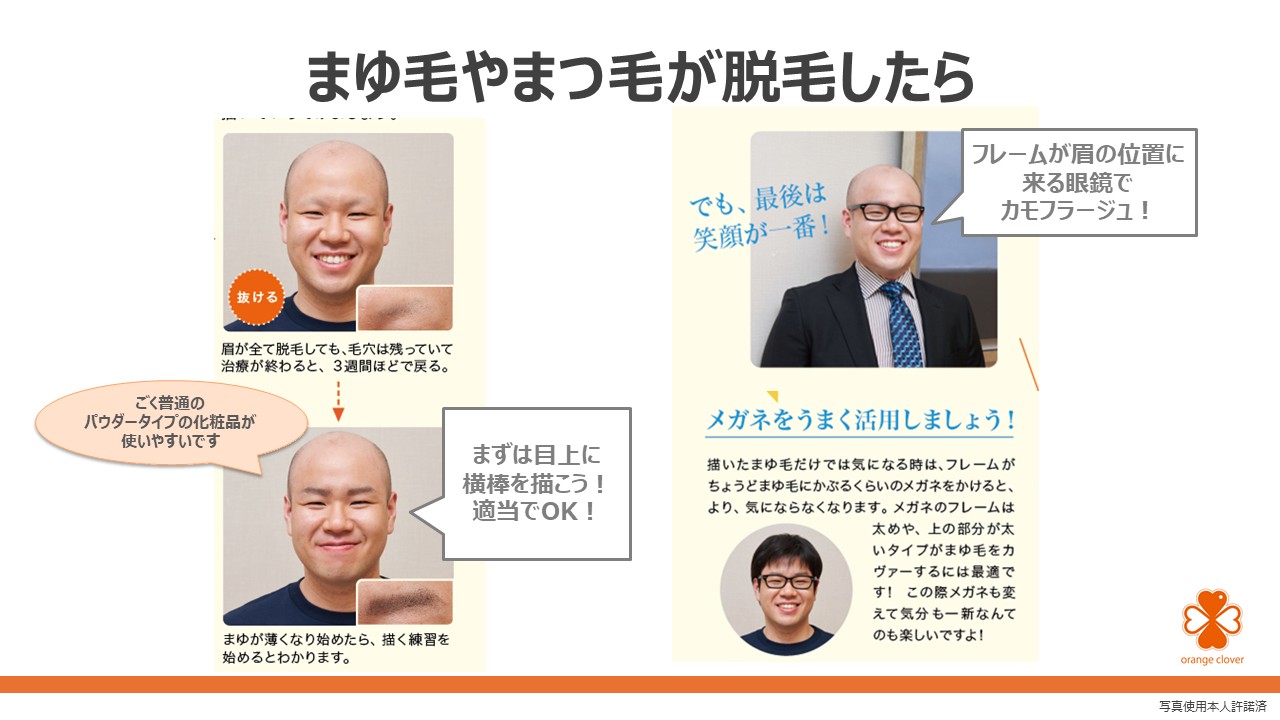 見た目の変化との付き合い方 ~ アピアランスケアを知ろうスライド11