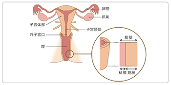 Vaginal1 Vaginal1