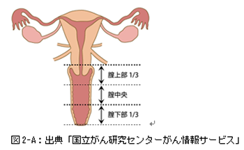Vaginal3 Vaginal3