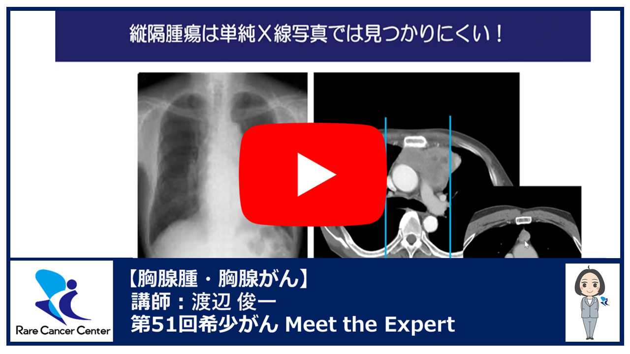 第51回胸腺腫・胸腺がん講演:渡辺 俊一2