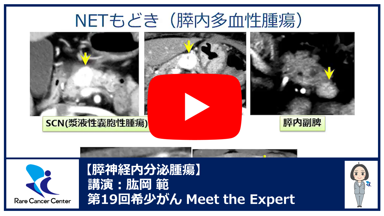 第19回神経内分泌腫瘍講演:肱岡 範2