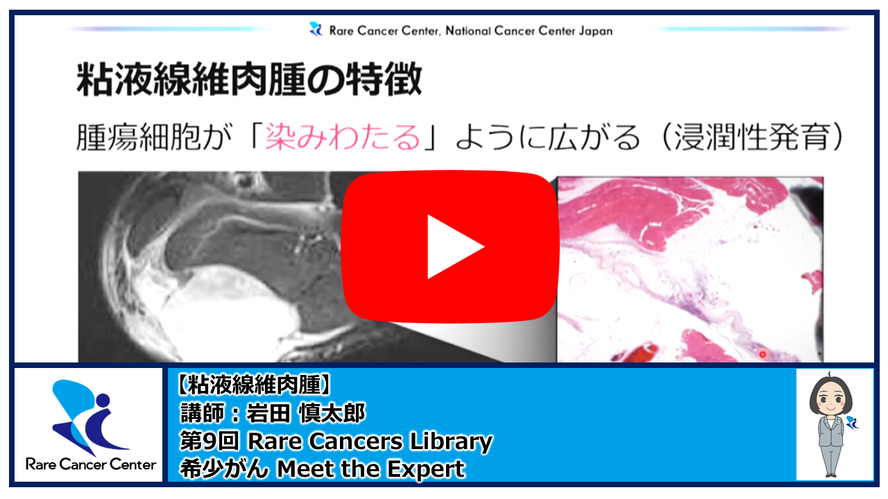 第9回Rare Cancers Library粘液線維肉腫講師:岩田 慎太郎2