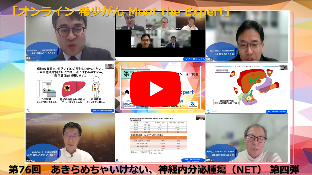 第76回 あきらめちゃいけない、神経内分泌腫瘍(NET) 第四弾 愛知県がんセンター×国立がん研究センター「オンライン希少がんMeet the Expert」