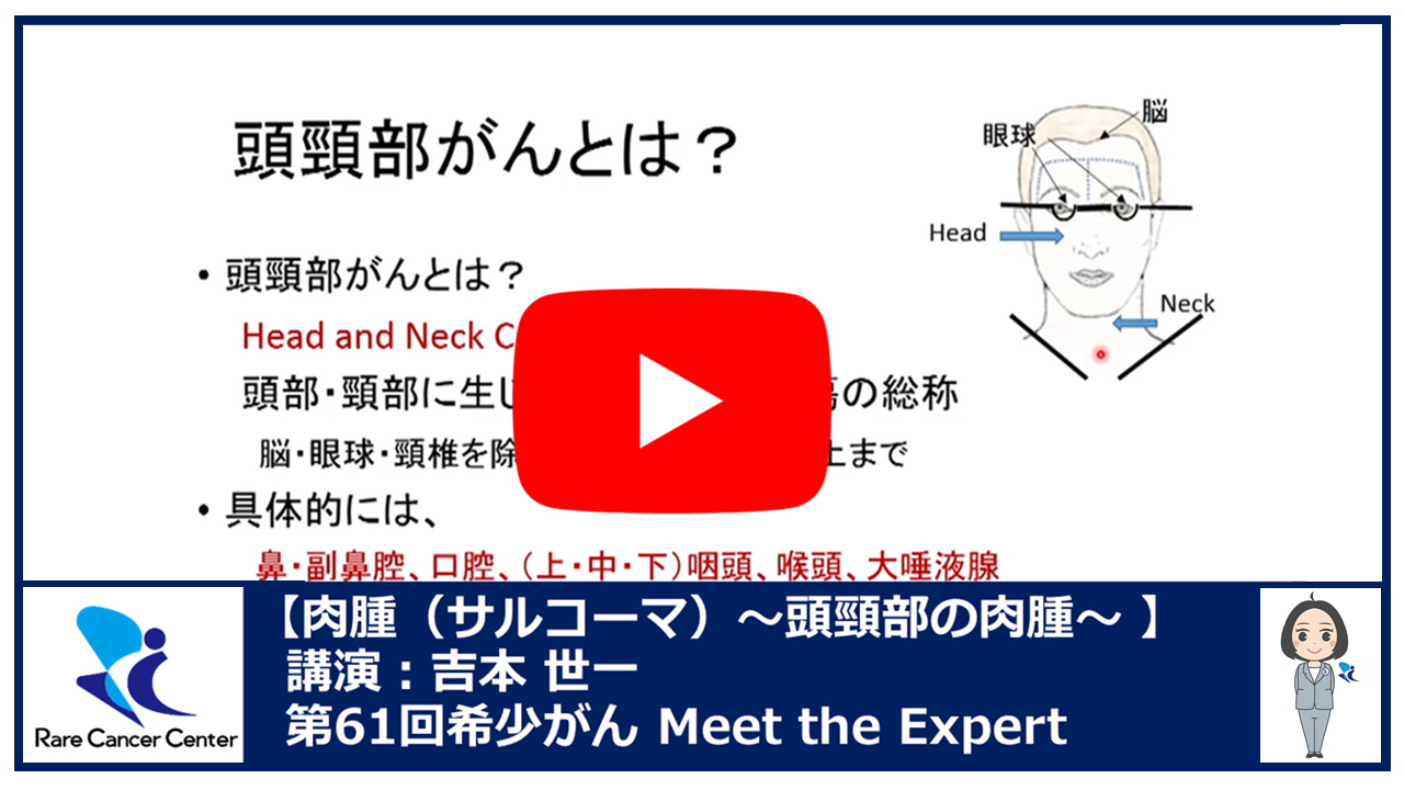 第61回~頭頸部の肉腫~吉本 世一2