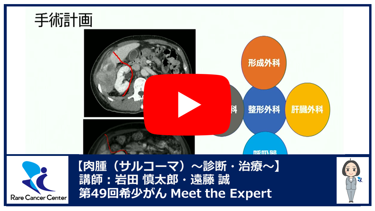 第49回肉腫（サルコーマ） 診断・治療  希少がんセンター×九州大学講演：岩田 慎太郎・遠藤 誠2