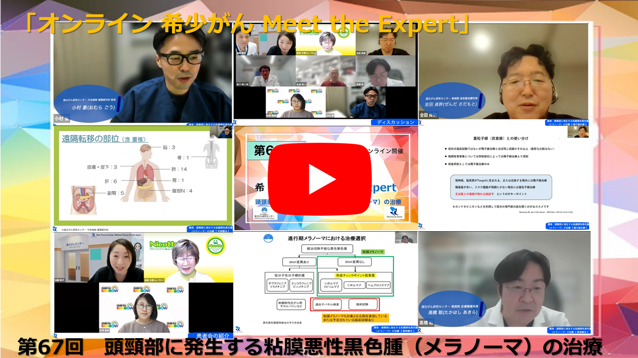 第67回 頭頸部に発生する粘膜悪性黒色腫（メラノーマ）の治療 「オンライン 希少がん Meet the Expert」