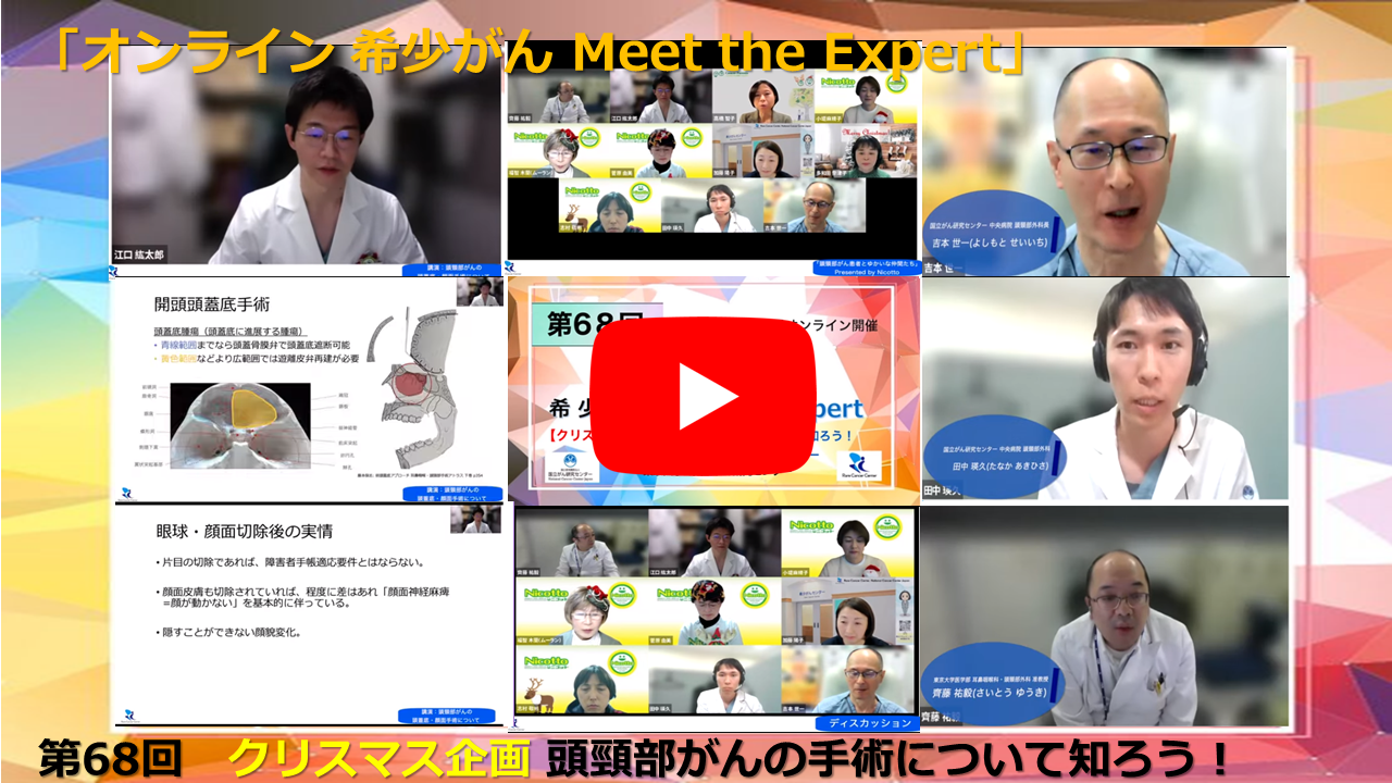 第68回 クリスマス企画 頭頸部がんの手術について知ろう！ 東京大学&times;国立がん研究センター「オンライン 希少がん Meet the Expert」