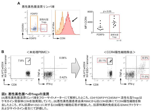 悪性黒色腫へのTregsの浸潤