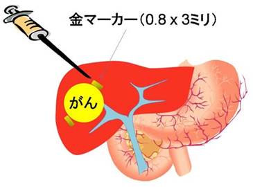 図 12